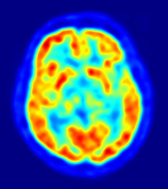 brain