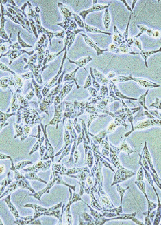 microscopische pathologische