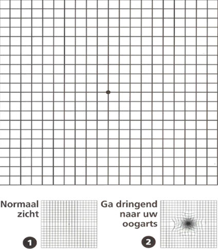 Maculadegeneratie 2