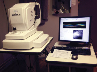 Optical Coherence Tomography : je voelt er niks van